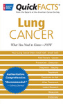 QuickFACTS&acirc;&bdquo;&cent; Lung Cancer