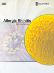 Allergic Rhinitis
